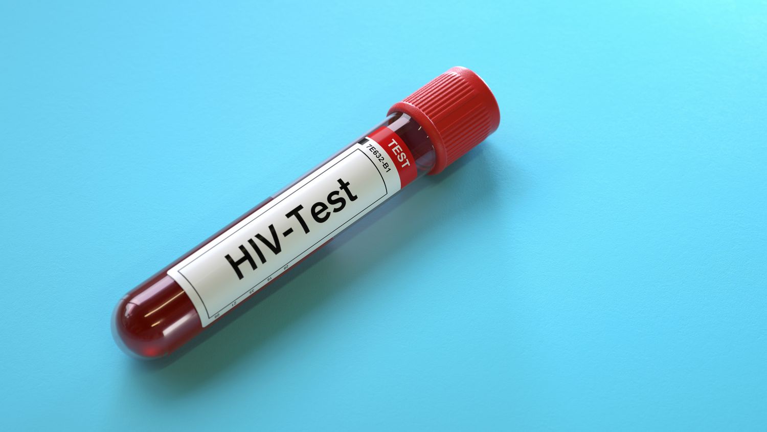 HIV-Test: Blut im Reagenzglas
